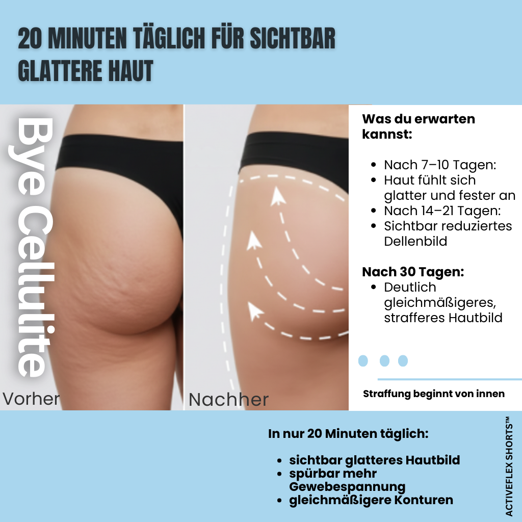 ActiveFlex Shorts™