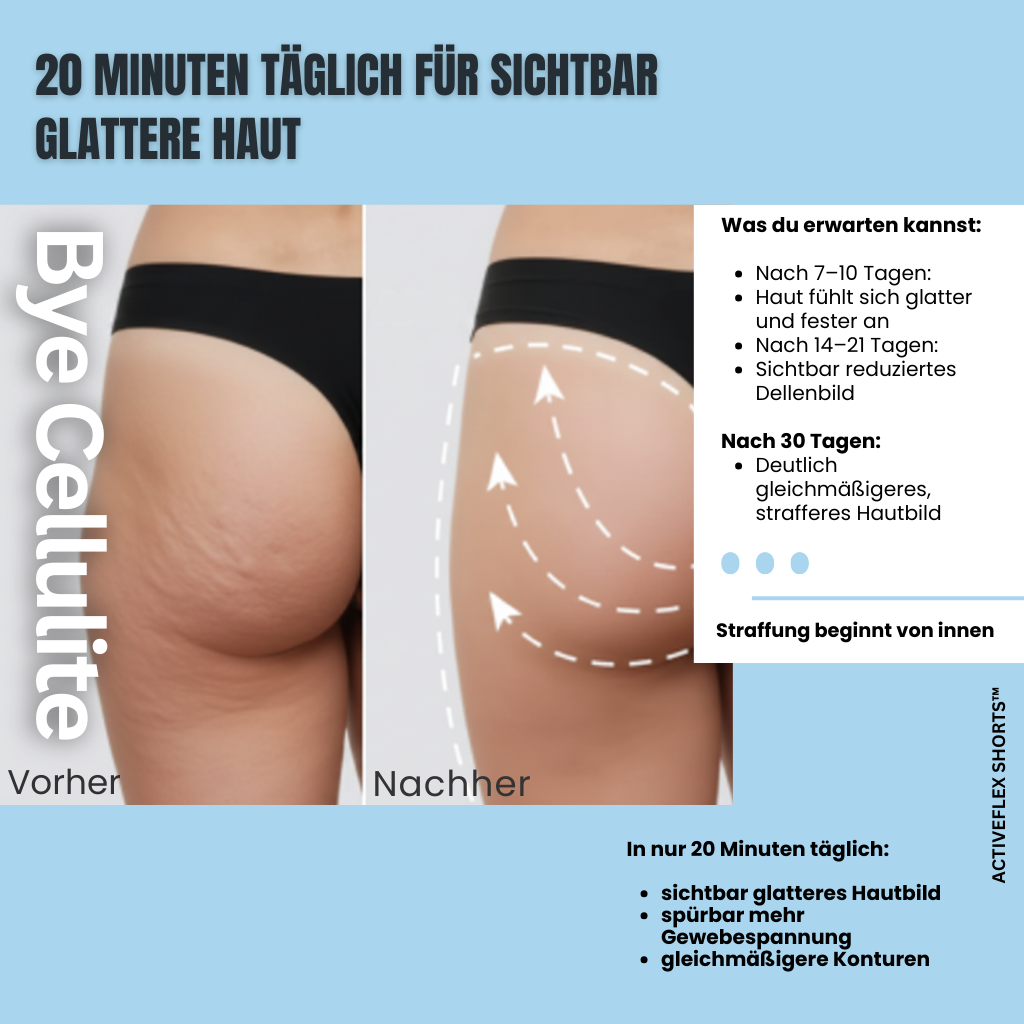 ActiveFlex Shorts™