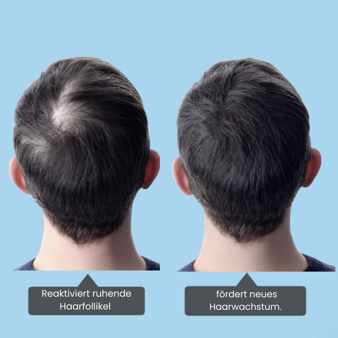 TERRAVO ™ LED-Technologie regeneriert die Kopfhaut